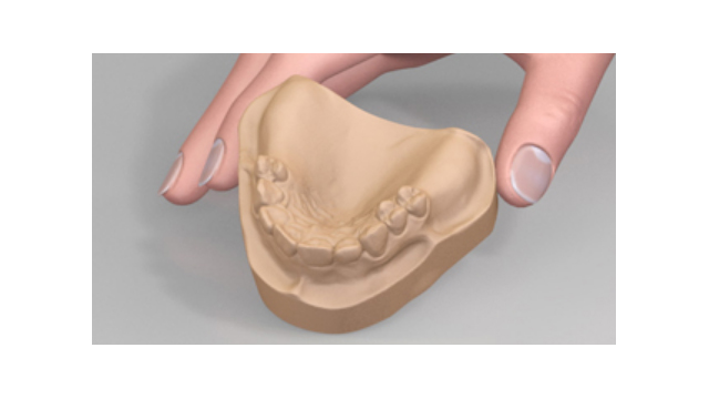 Gipsuri dentare clasa a III-a