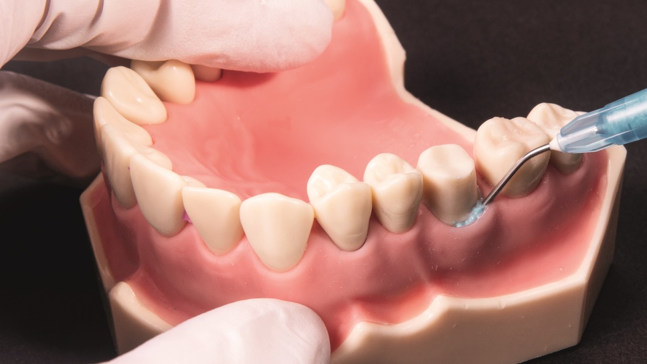 Managementul țesuturilor moi