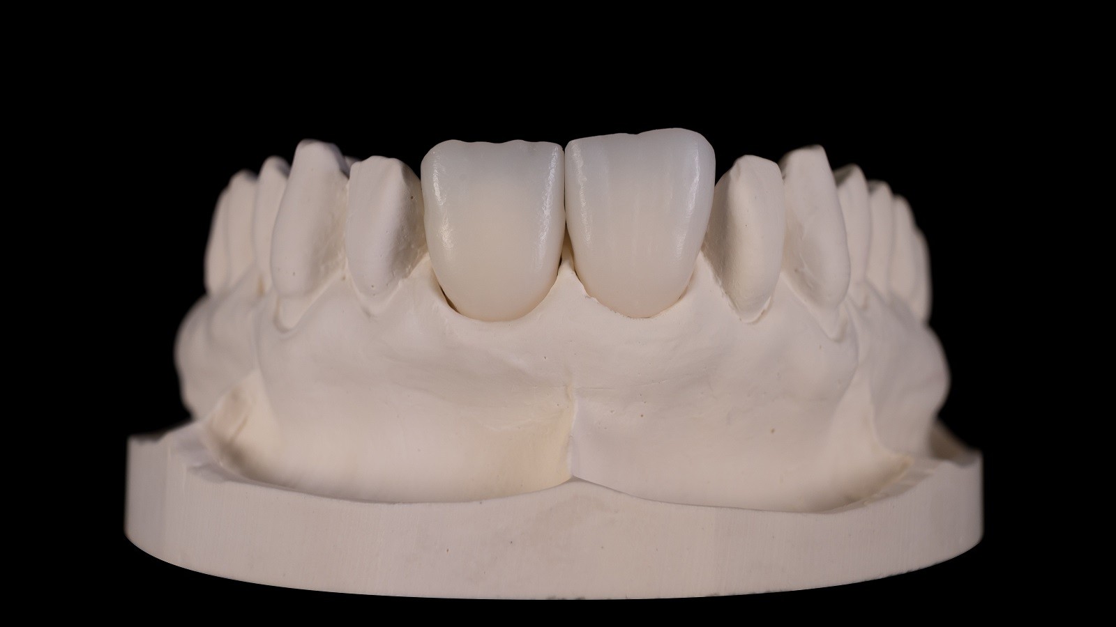 HeraCeram cre-active – conceptul „Bleach please”