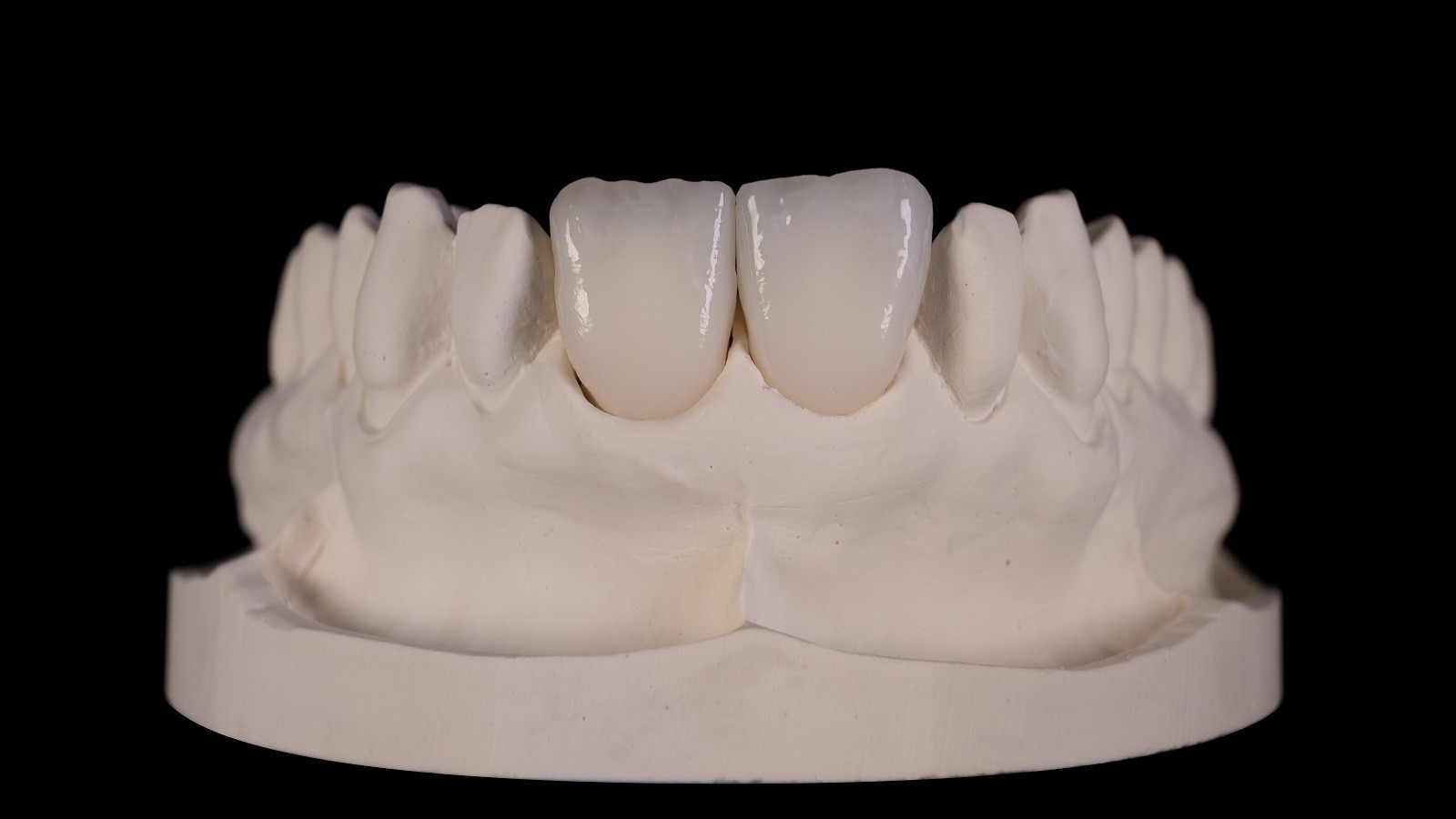 HeraCeram cre-active – conceptul „Bleach please”