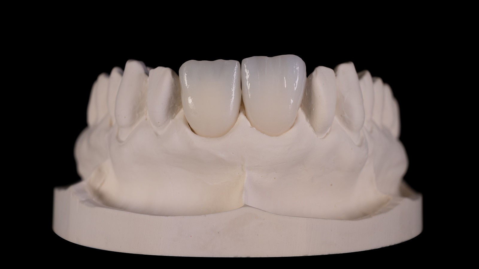 HeraCeram cre-active – conceptul „Bleach please”