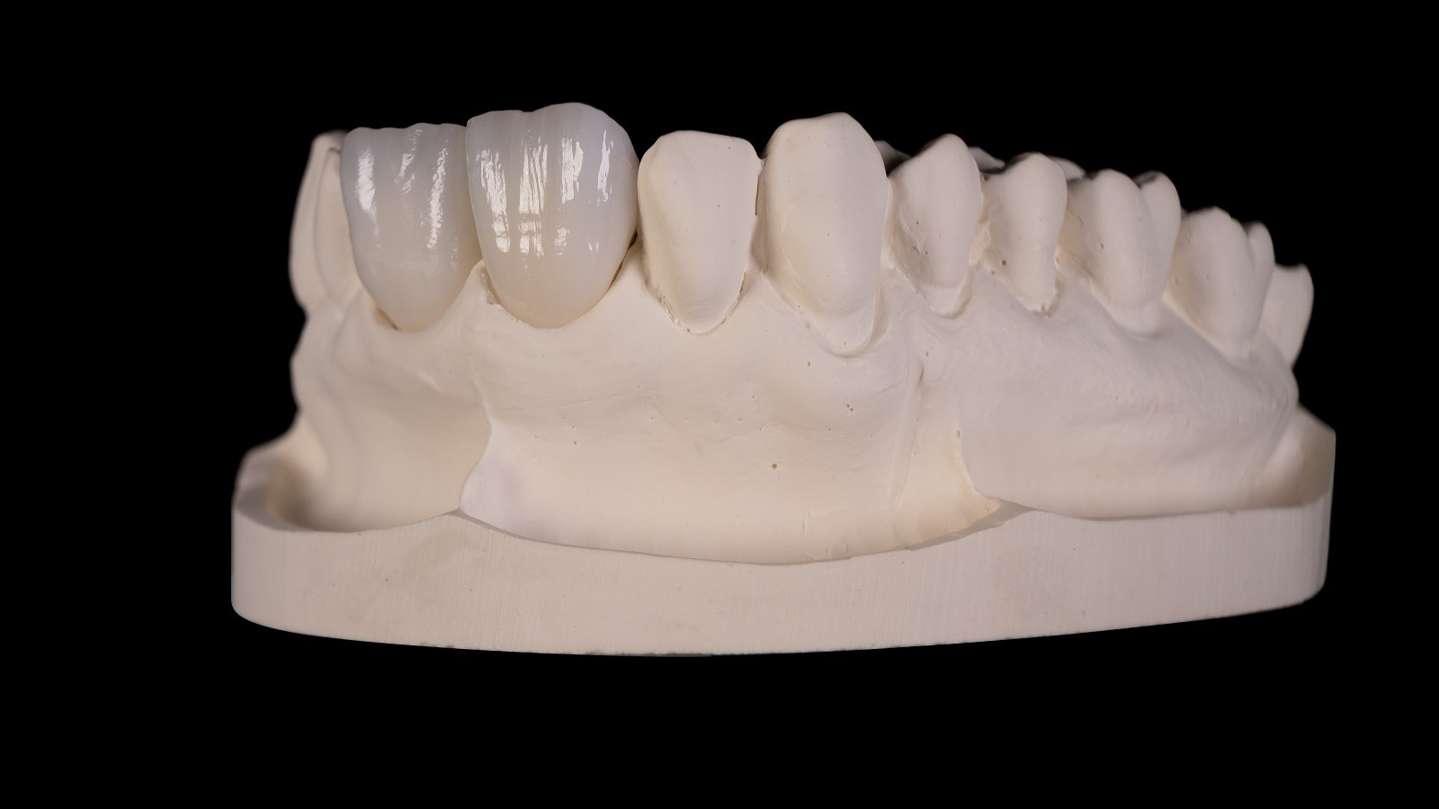 Rezultatul după arderea HeraCeram cre-active 2D