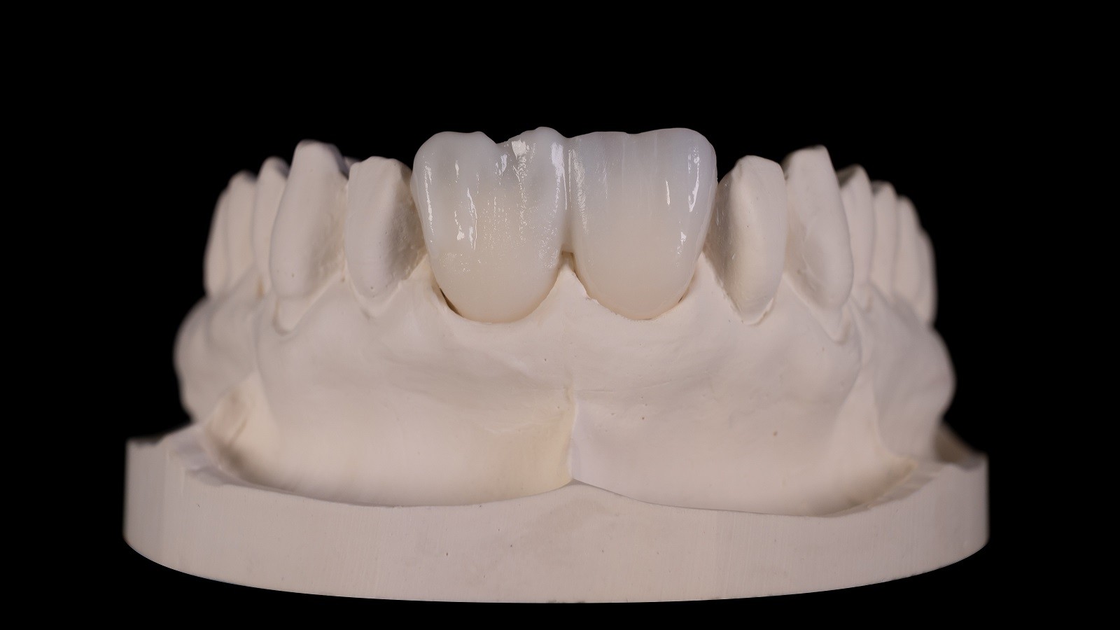 HeraCeram cre-active – conceptul „Bleach please”