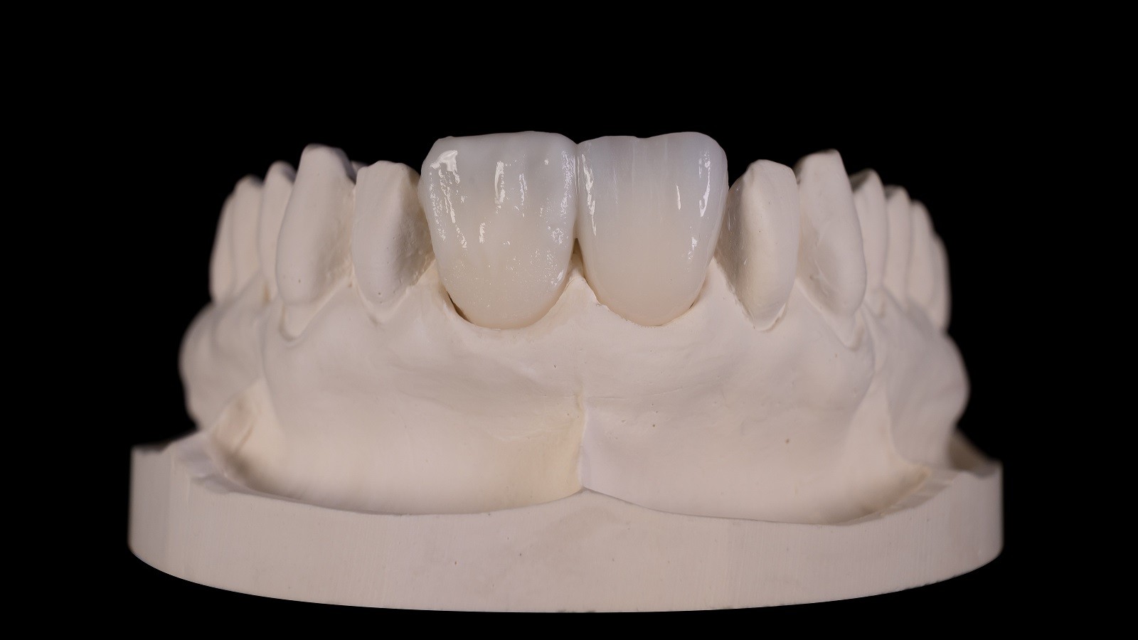 HeraCeram cre-active – conceptul „Bleach please”