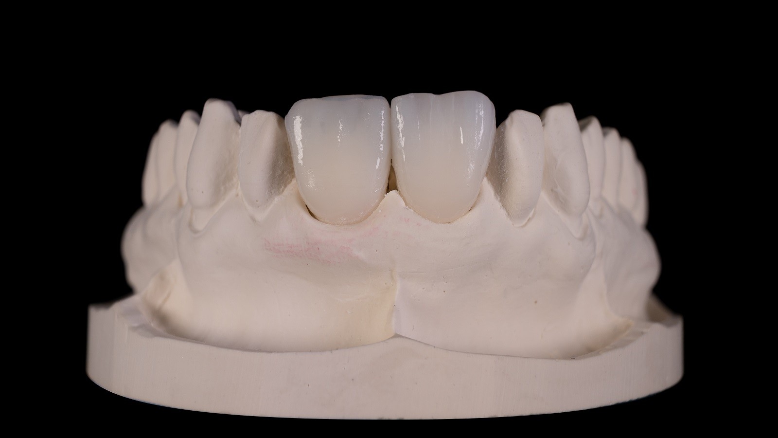 HeraCeram cre-active – conceptul „Bleach please”