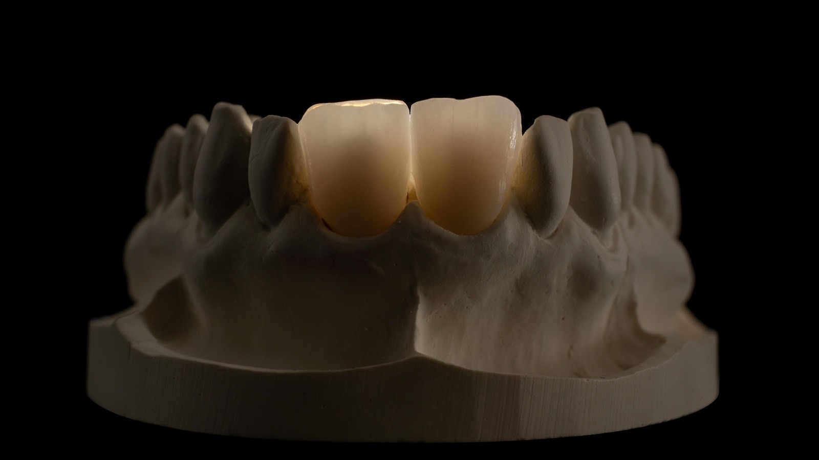 HeraCeram cre-active – conceptul „Bleach please”