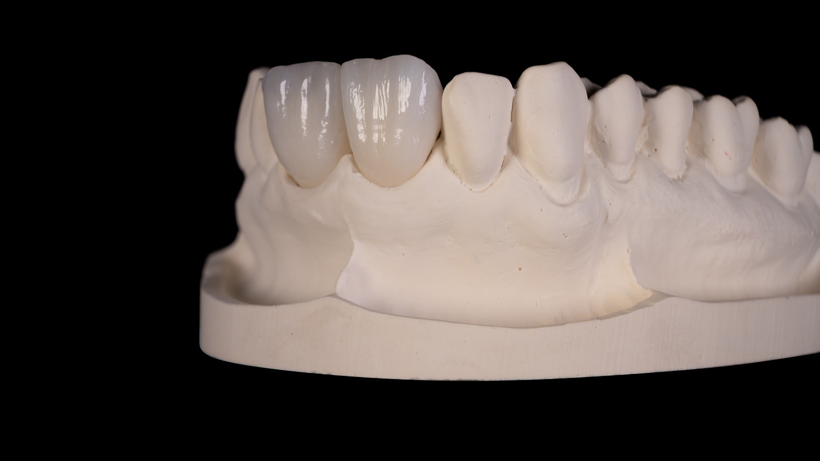 Rezultatul final după arderea HeraCeram cre-active 2D