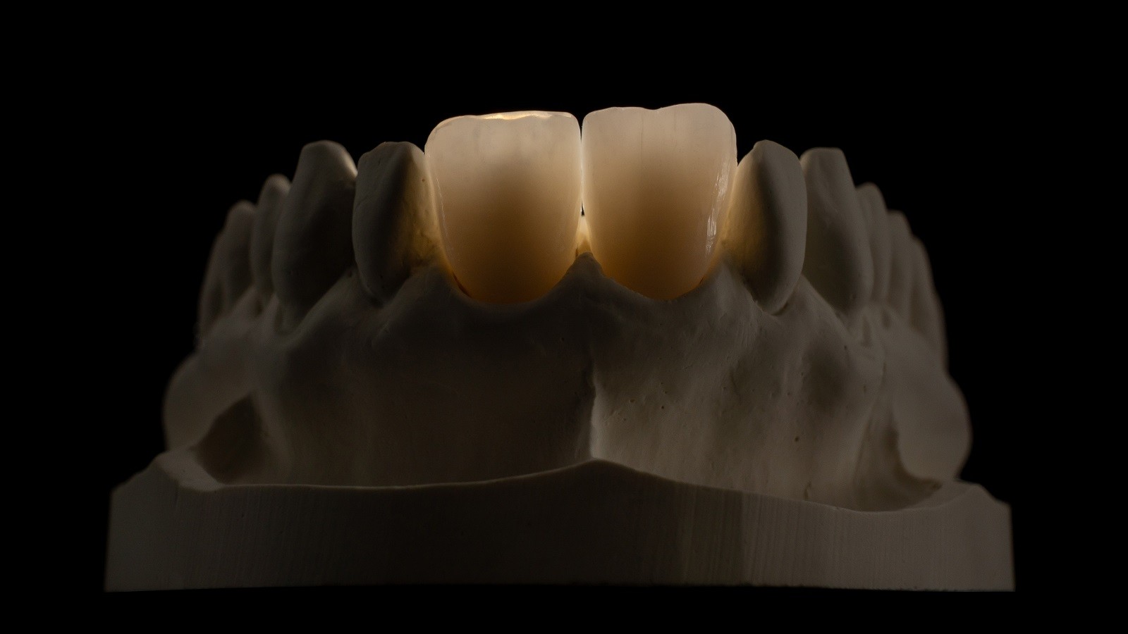 HeraCeram cre-active – conceptul „Bleach please”