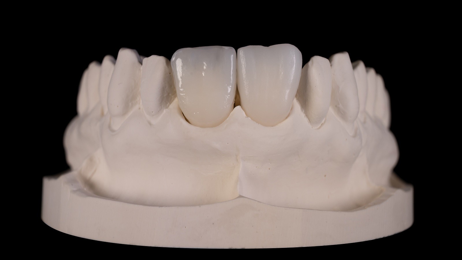 HeraCeram cre-active – conceptul „Bleach please”