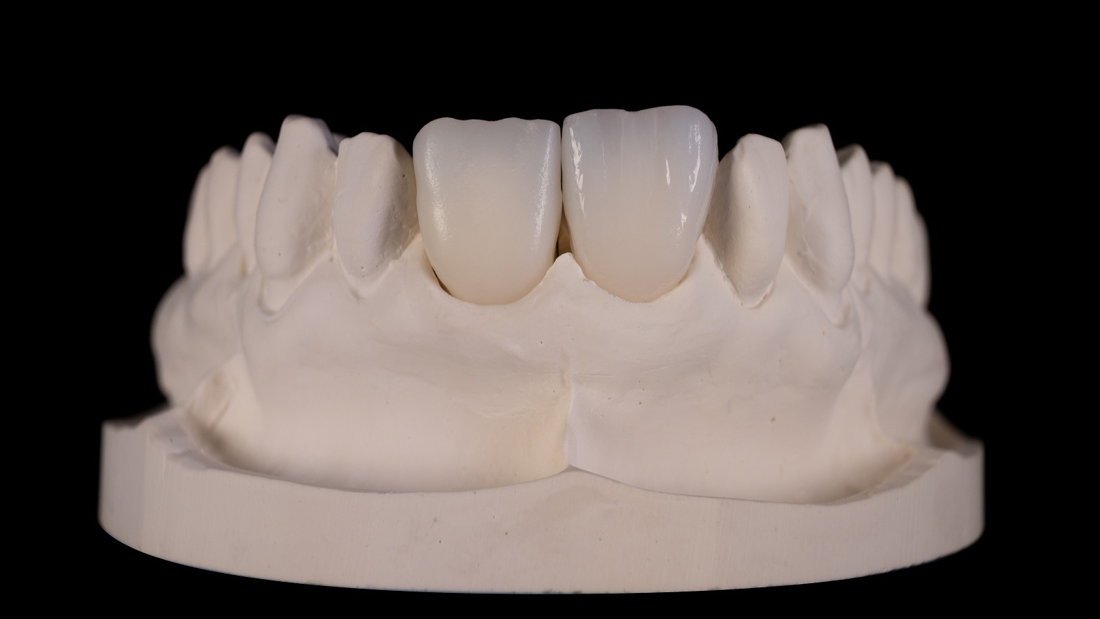 HeraCeram cre-active – conceptul „Bleach please”