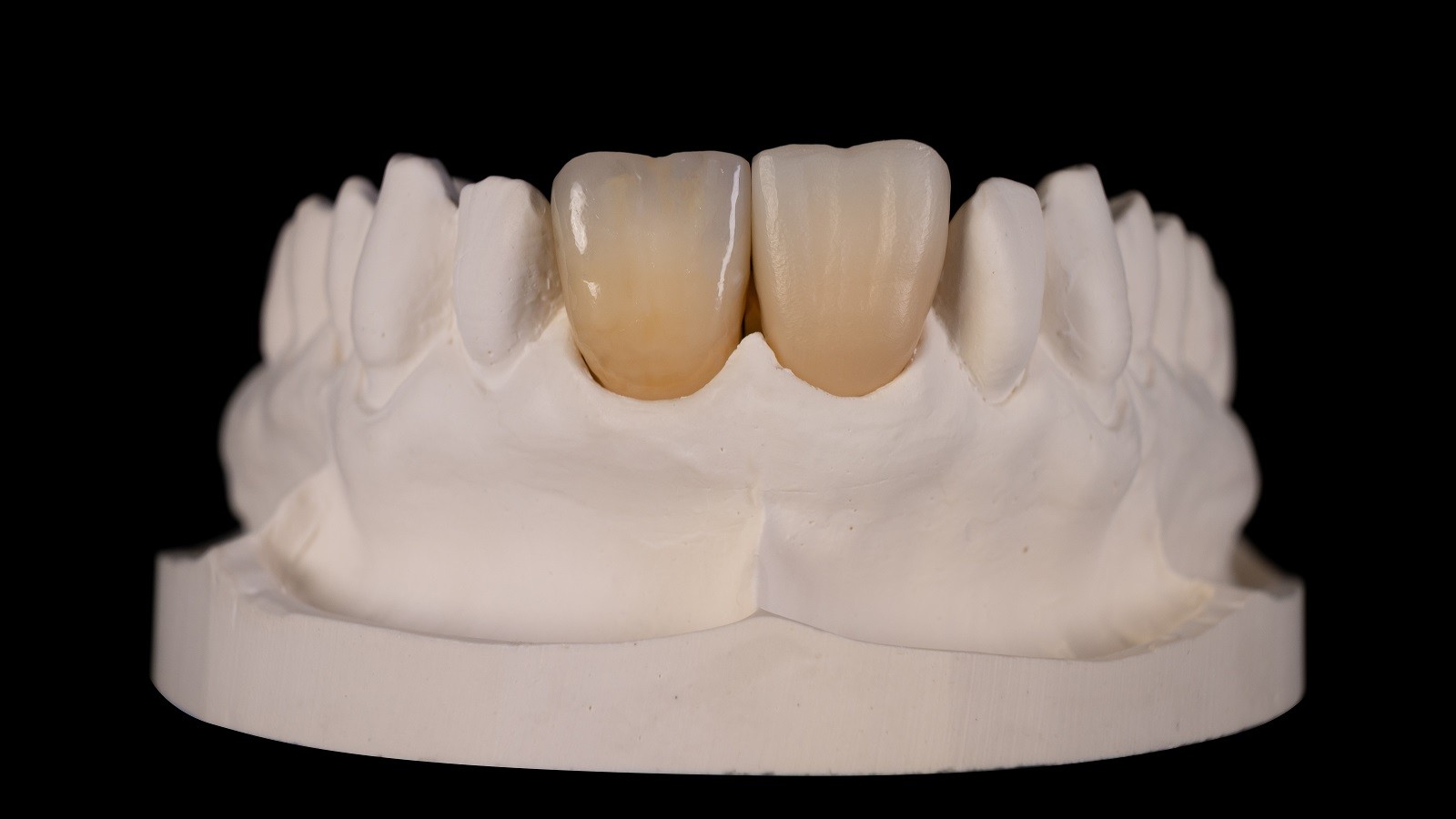 Rezultatul final după arderea HeraCeram cre-active 2D